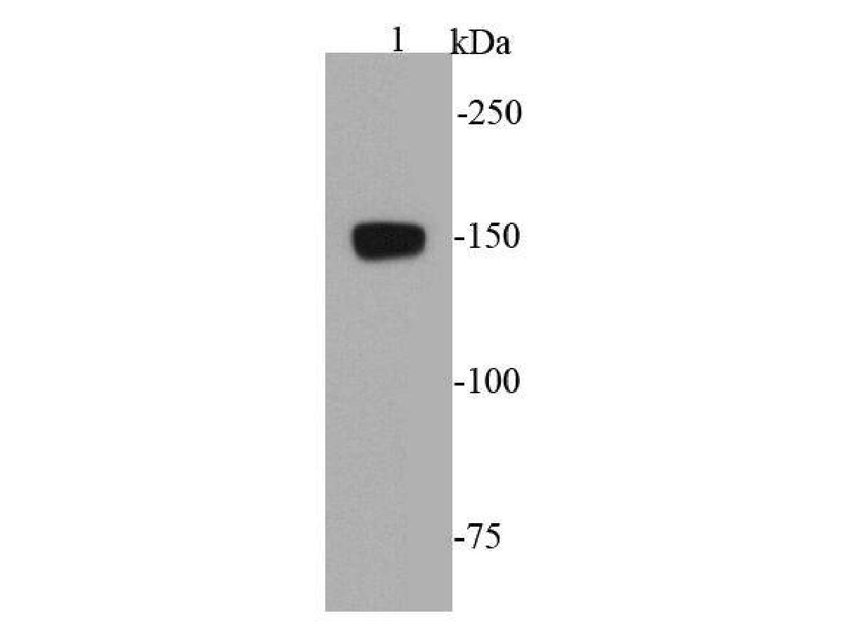 Western blot analysis of VEGFR1 on mouse liver tissue lysate using anti- VEGFR1 antibody at 1/1000 dilution.