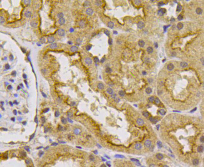 Immunohistochemical analysis of paraffin-embedded mouse heart tissue using anti-VEGFR1 antibody. Counter stained with hematoxylin.