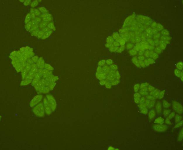 ICC staining AFP in HepG2 cells (green). Cells were fixed in paraformaldehyde, permeabilised with 0.25% Triton X100/PBS.