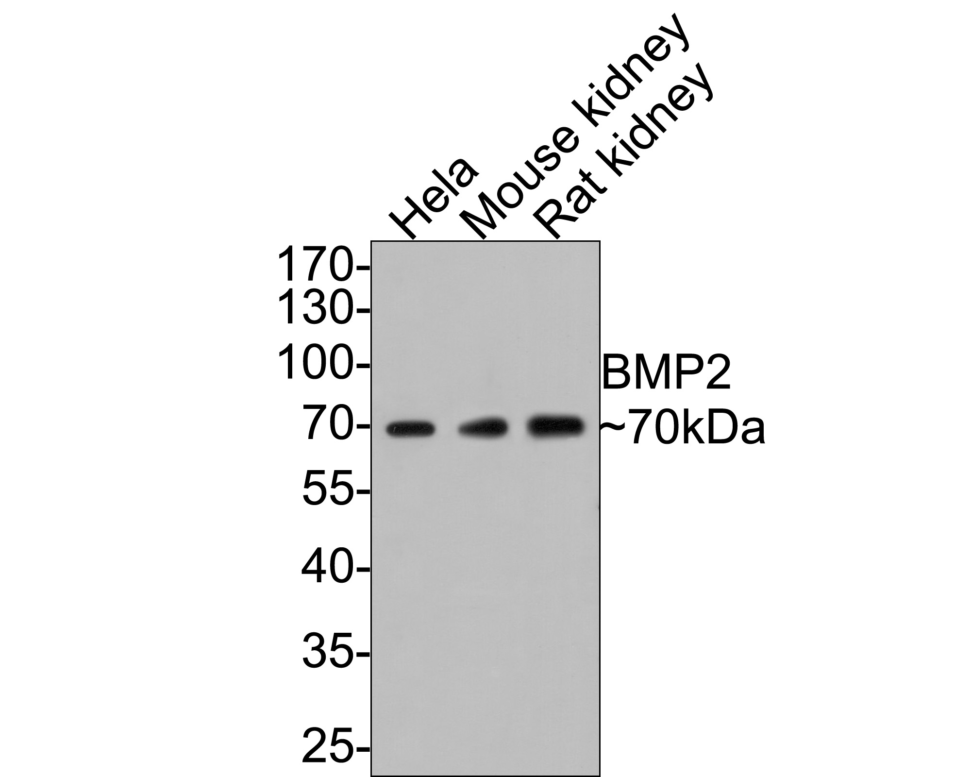Western blot analysis of BMP2 on different lysates with Rabbit anti-BMP2 antibody (ER80602) at 1/1,000 dilution.<br />
<br />
Lane 1: Hela cell lysate (10 µg/Lane)<br />
Lane 2: Mouse kidney tissue lysate (20 µg/Lane)<br />
Lane 2: Rat kidney tissue lysate (20 µg/Lane)<br />
<br />
Predicted band size: 45 kDa<br />
Observed band size: 70 kDa<br />
<br />
Exposure time: 2 minutes;<br />
<br />
10% SDS-PAGE gel.<br />
<br />
Proteins were transferred to a PVDF membrane and blocked with 5% NFDM/TBST for 1 hour at room temperature. The primary antibody (ER80602) at 1/1,000 dilution was used in 5% NFDM/TBST at room temperature for 2 hours. Goat Anti-Rabbit IgG - HRP Secondary Antibody (HA1001) at 1:300,000 dilution was used for 1 hour at room temperature.