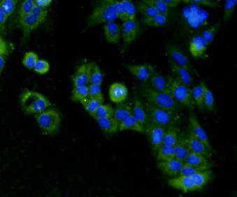 ICC staining BMP2 in Hela cells (green). Cells were fixed in paraformaldehyde, permeabilised with 0.25% Triton X100/PBS. DAPI was used to stain the cell nuclei (blue).