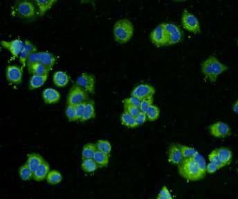 ICC staining BMP2 in MCF-7 cells (green). Cells were fixed in paraformaldehyde, permeabilised with 0.25% Triton X100/PBS. DAPI was used to stain the cell nuclei (blue).