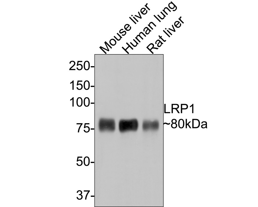 Farklı lizatlar üzerinde LRP1'in Western blot analizi.  Proteinler bir PVDF membranına aktarıldı ve oda sıcaklığında 1 saat boyunca PBS içinde %5 BSA ile bloke edildi.  Primer antikor (ET1601-1, 1/500), oda sıcaklığında 2 saat boyunca %5 BSA içinde kullanıldı.  Keçi Anti-Rabbit IgG - HRP Sekonder Antikoru (HA1001) 1:5,000 seyreltmede oda sıcaklığında 1 saat kullanıldı.  Pozitif kontrol: Şerit 1: fare karaciğer dokusu lizatı Şerit 2: fare akciğer dokusu lizatı Şerit 3: insan karaciğer dokusu lizatı Şerit 4: insan akciğer dokusu lizatı