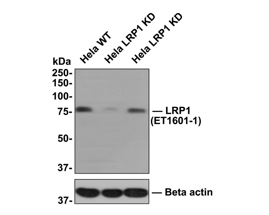 All lanes: Western blot analysis of LRP1 with anti-LRP1 antibody (ET1601-1) at 1:1,000 dilution.<br />
Lane 1: Wild-type Hela whole cell lysate (10 µg).<br />
Lane 2/3: LRP1 knockdown Hela whole cell lysate (10 µg).<br />
<br />
ET1601-1 was shown to specifically react with LRP1 in wild-type Hela cells. Weakened bands were observed when LRP1 knockdown samples were tested. Wild-type and LRP1 knockdown samples were subjected to SDS-PAGE. Proteins were transferred to a PVDF membrane and blocked with 5% NFDM in TBST for 1 hour at room temperature. The primary antibody (ET1601-1, 1:1,000) was used in 5% BSA at room temperature for 2 hours. Goat Anti-Rabbit IgG-HRP Secondary Antibody (HA1001) at 1:300,000 dilution was used for 1 hour at room temperature.