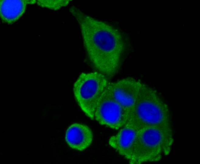 ICC staining of LRP1 in MCF-7 cells (green). Formalin fixed cells were permeabilized with 0.1% Triton X-100 in TBS for 10 minutes at room temperature and blocked with 1% Blocker BSA for 15 minutes at room temperature. Cells were probed with the primary antibody (ET1601-1, 1/50) for 1 hour at room temperature, washed with PBS. Alexa Fluor®488 Goat anti-Rabbit IgG was used as the secondary antibody at 1/1,000 dilution. The nuclear counter stain is DAPI (blue).