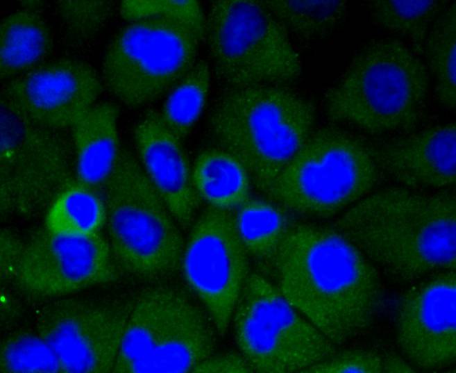 ICC staining of LRP1 in HUVEC cells (green). Formalin fixed cells were permeabilized with 0.1% Triton X-100 in TBS for 10 minutes at room temperature and blocked with 1% Blocker BSA for 15 minutes at room temperature. Cells were probed with the primary antibody (ET1601-1, 1/50) for 1 hour at room temperature, washed with PBS. Alexa Fluor®488 Goat anti-Rabbit IgG was used as the secondary antibody at 1/1,000 dilution. The nuclear counter stain is DAPI (blue).