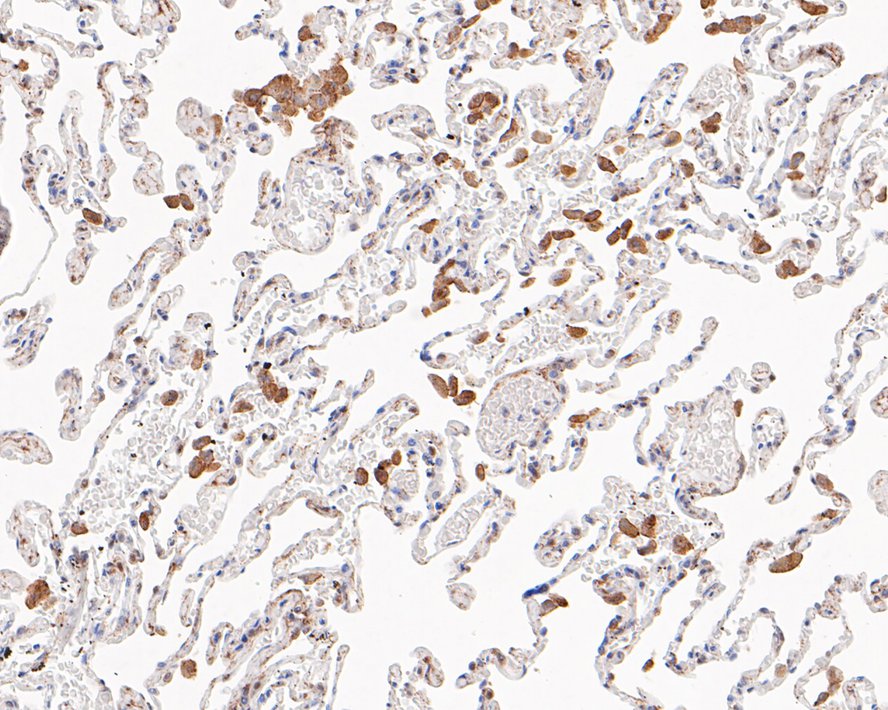 Immunohistochemical analysis of paraffin-embedded human lung tissue using anti-LRP1 antibody. The section was pre-treated using heat mediated antigen retrieval with Tris-EDTA buffer (pH 8.0-8.4) for 20 minutes.The tissues were blocked in 5% BSA for 30 minutes at room temperature, washed with ddH2O and PBS, and then probed with the primary antibody (ET1601-1, 1/50) for 30 minutes at room temperature. The detection was performed using an HRP conjugated compact polymer system. DAB was used as the chromogen. Tissues were counterstained with hematoxylin and mounted with DPX.