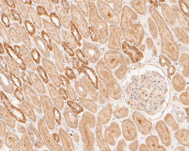 Immunohistochemical analysis of paraffin-embedded human kidney tissue using anti-Hsp70 antibody. The section was pre-treated using heat mediated antigen retrieval with sodium citrate buffer (pH 6.0) for 20 minutes. The tissues were blocked in 5% BSA for 30 minutes at room temperature, washed with ddH2O and PBS, and then probed with the primary antibody (ET1601-11, 1/50)  for 30 minutes at room temperature. The detection was performed using an HRP conjugated compact polymer system. DAB was used as the chromogen. Tissues were counterstained with hematoxylin and mounted with DPX.