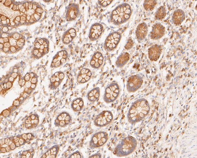 Immunohistochemical analysis of paraffin-embedded human small intestine tissue using anti-Hsp70 antibody. The section was pre-treated using heat mediated antigen retrieval with sodium citrate buffer (pH 6.0) for 20 minutes. The tissues were blocked in 5% BSA for 30 minutes at room temperature, washed with ddH2O and PBS, and then probed with the primary antibody (ET1601-11, 1/50)  for 30 minutes at room temperature. The detection was performed using an HRP conjugated compact polymer system. DAB was used as the chromogen. Tissues were counterstained with hematoxylin and mounted with DPX.
