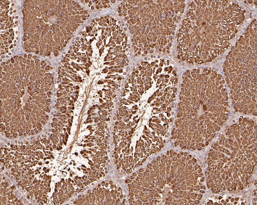 Immunohistochemical analysis of paraffin-embedded mouse testis tissue with Rabbit anti-Hsp70 antibody (ET1601-11) at 1/500 dilution.<br />
<br />
The section was pre-treated using heat mediated antigen retrieval with sodium citrate buffer (pH 6.0) for 2 minutes. The tissues were blocked in 1% BSA for 20 minutes at room temperature, washed with ddH2O and PBS, and then probed with the primary antibody (ET1601-11) at 1/500 dilution for 1 hour at room temperature. The detection was performed using an HRP conjugated compact polymer system. DAB was used as the chromogen. Tissues were counterstained with hematoxylin and mounted with DPX.
