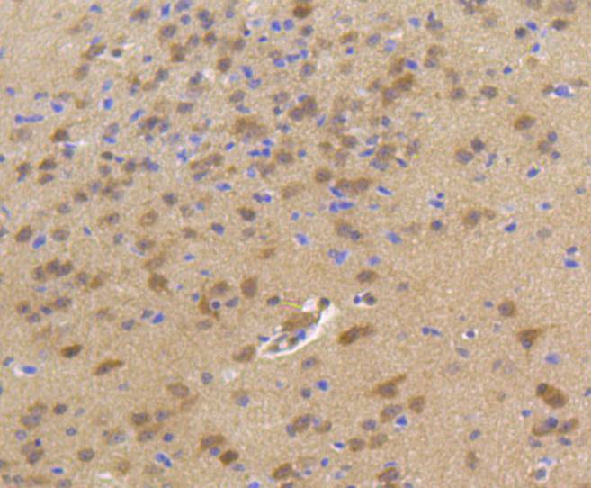 Immunohistochemical analysis of paraffin-embedded mouse brain tissue using anti-Hsp70 antibody. The section was pre-treated using heat mediated antigen retrieval with Tris-EDTA buffer (pH 8.0-8.4) for 20 minutes.The tissues were blocked in 5% BSA for 30 minutes at room temperature, washed with ddH2O and PBS, and then probed with the primary antibody (ET1601-11, 1/100) for 30 minutes at room temperature. The detection was performed using an HRP conjugated compact polymer system. DAB was used as the chromogen. Tissues were counterstained with hematoxylin and mounted with DPX.