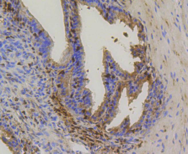 Immunohistochemical analysis of paraffin-embedded mouse prostate tissue using anti-Hsp70 antibody. The section was pre-treated using heat mediated antigen retrieval with Tris-EDTA buffer (pH 8.0-8.4) for 20 minutes.The tissues were blocked in 5% BSA for 30 minutes at room temperature, washed with ddH2O and PBS, and then probed with the primary antibody (ET1601-11, 1/100) for 30 minutes at room temperature. The detection was performed using an HRP conjugated compact polymer system. DAB was used as the chromogen. Tissues were counterstained with hematoxylin and mounted with DPX.
