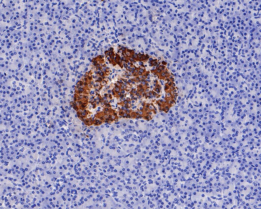 Immunohistochemical analysis of paraffin-embedded human pancreas tissue with Rabbit anti-Insulin antibody (ET1601-12) at 1/20,000 dilution.<br />
<br />
The section was pre-treated using heat mediated antigen retrieval with Tris-EDTA buffer (pH 9.0) for 20 minutes. The tissues were blocked in 1% BSA for 20 minutes at room temperature, washed with ddH2O and PBS, and then probed with the primary antibody (ET1601-12) at 1/20,000 dilution for 1 hour at room temperature. The detection was performed using an HRP conjugated compact polymer system. DAB was used as the chromogen. Tissues were counterstained with hematoxylin and mounted with DPX.