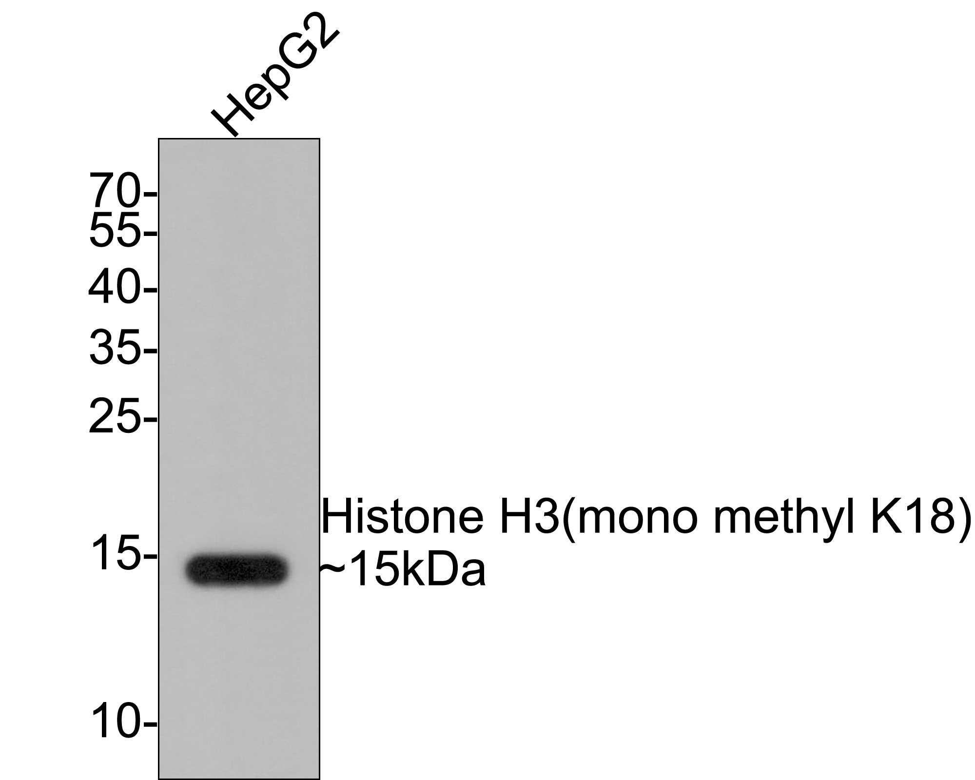 Western blot analysis of Histone H3(mono methyl K18) on HepG2 cell lysates with Rabbit anti-Histone H3(mono methyl K18) antibody (ET1601-14) at 1/500 dilution.<br />
<br />
Lysates/proteins at 10 µg/Lane.<br />
<br />
Predicted band size: 15 kDa<br />
Observed band size: 15 kDa<br />
<br />
Exposure time: 2 minutes;<br />
<br />
15% SDS-PAGE gel.<br />
<br />
Proteins were transferred to a PVDF membrane and blocked with 5% NFDM/TBST for 1 hour at room temperature. The primary antibody (ET1601-14) at 1/500 dilution was used in 5% NFDM/TBST at room temperature for 2 hours. Goat Anti-Rabbit IgG - HRP Secondary Antibody (HA1001) at 1:300,000 dilution was used for 1 hour at room temperature.