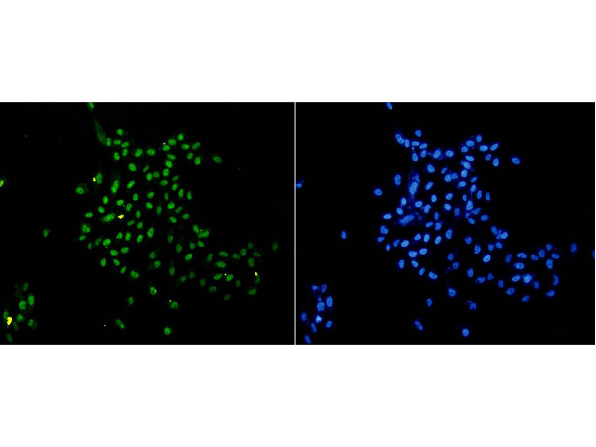 ICC staining Histone H3(mono methyl K18) in PC-3M cells (green). The nuclear counter stain is DAPI (blue). Cells were fixed in paraformaldehyde, permeabilised with 0.25% Triton X100/PBS.
