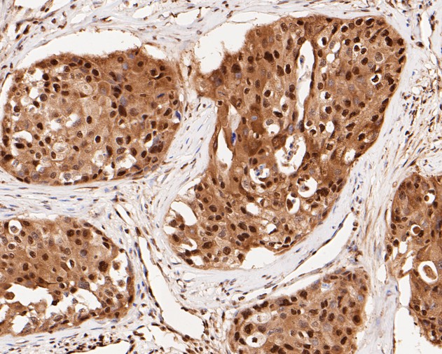 Immunohistochemical analysis of paraffin-embedded human thyroid tissue using anti-CREB antibody. The section was pre-treated using heat mediated antigen retrieval with sodium citrate buffer (pH 6.0) for 2 minutes. The tissues were blocked in 5% BSA for 30 minutes at room temperature, washed with ddH2O and PBS, and then probed with the primary antibody (ET1601-15, 1/500)  for 30 minutes at room temperature. The detection was performed using an HRP conjugated compact polymer system. DAB was used as the chromogen. Tissues were counterstained with hematoxylin and mounted with DPX.