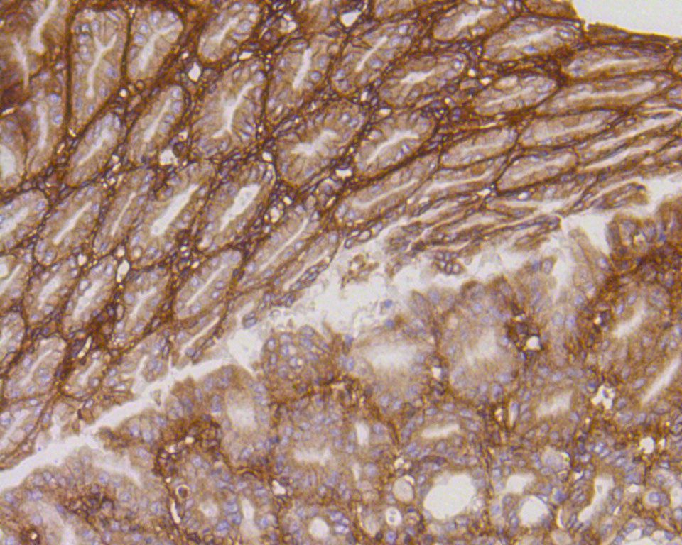 Immunohistochemical analysis of paraffin-embedded mouse stomach tissue using anti-Integrin beta 1 antibody. The section was pre-treated using heat mediated antigen retrieval with Tris-EDTA buffer (pH 9.0) for 20 minutes.The tissues were blocked in 5% BSA for 30 minutes at room temperature, washed with ddH2O and PBS, and then probed with the primary antibody (ET1601-17, 1/200) for 30 minutes at room temperature. The detection was performed using an HRP conjugated compact polymer system. DAB was used as the chromogen. Tissues were counterstained with hematoxylin and mounted with DPX.