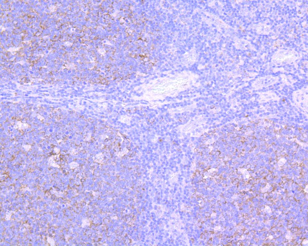 Immunohistochemical analysis of paraffin-embedded human tonsil tissue using anti-VCAM1 antibody. The section was pre-treated using heat mediated antigen retrieval with Tris-EDTA buffer (pH 9.0) for 20 minutes.The tissues were blocked in 5% BSA for 30 minutes at room temperature, washed with ddH2O and PBS, and then probed with the primary antibody (ET1601-18, 1/200) for 30 minutes at room temperature. The detection was performed using an HRP conjugated compact polymer system. DAB was used as the chromogen. Tissues were counterstained with hematoxylin and mounted with DPX.