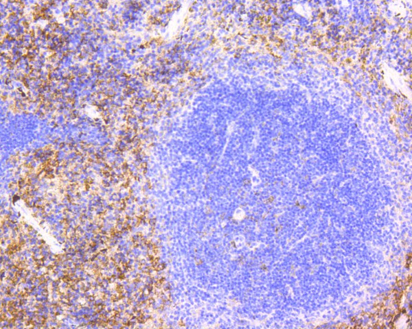 Immunohistochemical analysis of paraffin-embedded mouse spleen tissue using anti-VCAM1 antibody. The section was pre-treated using heat mediated antigen retrieval with Tris-EDTA buffer (pH 9.0) for 20 minutes.The tissues were blocked in 5% BSA for 30 minutes at room temperature, washed with ddH2O and PBS, and then probed with the primary antibody (ET1601-18, 1/200) for 30 minutes at room temperature. The detection was performed using an HRP conjugated compact polymer system. DAB was used as the chromogen. Tissues were counterstained with hematoxylin and mounted with DPX.
