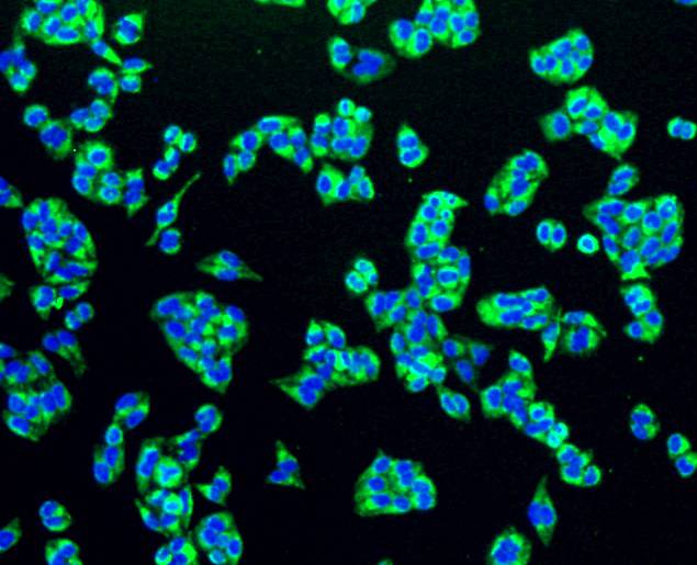 ICC staining of PBR in Hela cells (green). Formalin fixed cells were permeabilized with 0.1% Triton X-100 in TBS for 10 minutes at room temperature and blocked with 1% Blocker BSA for 15 minutes at room temperature. Cells were probed with the primary antibody (ET1601-19, 1/50) for 1 hour at room temperature, washed with PBS. Alexa Fluor®488 Goat anti-Rabbit IgG was used as the secondary antibody at 1/1,000 dilution. The nuclear counter stain is DAPI (blue).