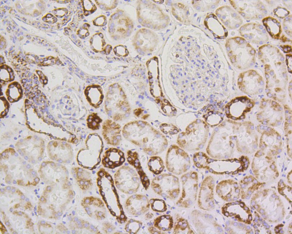 Immunohistochemical analysis of paraffin-embedded human kidney tissue with Rabbit anti-PBR antibody (ET1601-19) at 1/200 dilution.<br />
<br />
The section was pre-treated using heat mediated antigen retrieval with Tris-EDTA buffer (pH 9.0) for 20 minutes. The tissues were blocked in 1% BSA for 20 minutes at room temperature, washed with ddH2O and PBS, and then probed with the primary antibody (ET1601-19) at 1/200 dilution for 1 hour at room temperature. The detection was performed using an HRP conjugated compact polymer system. DAB was used as the chromogen. Tissues were counterstained with hematoxylin and mounted with DPX.
