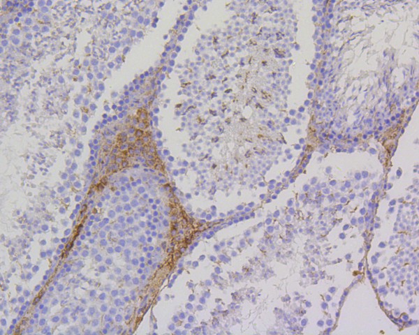 Immunohistochemical analysis of paraffin-embedded mouse testis tissue with Rabbit anti-PBR antibody (ET1601-19) at 1/50 dilution.<br />
<br />
The section was pre-treated using heat mediated antigen retrieval with Tris-EDTA buffer (pH 9.0) for 20 minutes. The tissues were blocked in 1% BSA for 20 minutes at room temperature, washed with ddH2O and PBS, and then probed with the primary antibody (ET1601-19) at 1/50 dilution for 1 hour at room temperature. The detection was performed using an HRP conjugated compact polymer system. DAB was used as the chromogen. Tissues were counterstained with hematoxylin and mounted with DPX.