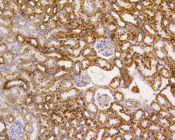 Immunohistochemical analysis of paraffin-embedded mouse kidney tissue with Rabbit anti-PBR antibody (ET1601-19) at 1/200 dilution.<br />
<br />
The section was pre-treated using heat mediated antigen retrieval with Tris-EDTA buffer (pH 9.0) for 20 minutes. The tissues were blocked in 1% BSA for 20 minutes at room temperature, washed with ddH2O and PBS, and then probed with the primary antibody (ET1601-19) at 1/200 dilution for 1 hour at room temperature. The detection was performed using an HRP conjugated compact polymer system. DAB was used as the chromogen. Tissues were counterstained with hematoxylin and mounted with DPX.