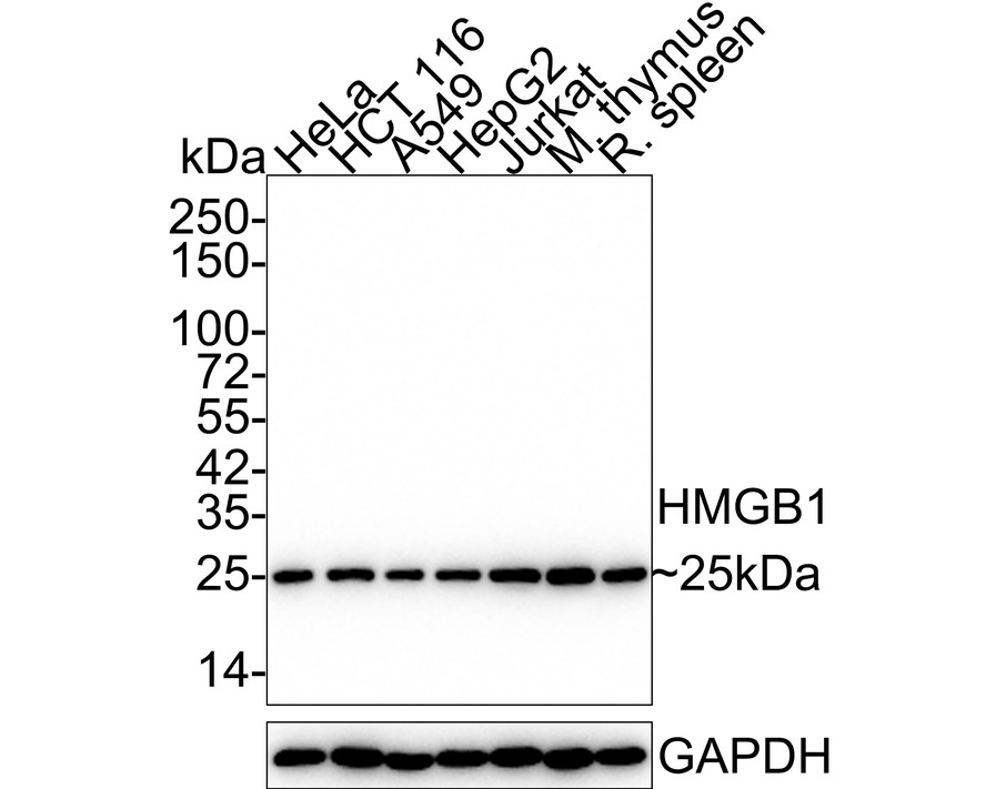 Immunohistochemical analysis of paraffin-embedded human tonsil tissue with Rabbit anti-HMGB1 antibody (ET1601-2) at 1/5,000 dilution.<br />
<br />
The section was pre-treated using heat mediated antigen retrieval with sodium citrate buffer (pH 6.0) for 2 minutes. The tissues were blocked in 1% BSA for 20 minutes at room temperature, washed with ddH2O and PBS, and then probed with the primary antibody (ET1601-2) at 1/5,000 dilution for 1 hour at room temperature. The detection was performed using an HRP conjugated compact polymer system. DAB was used as the chromogen. Tissues were counterstained with hematoxylin and mounted with DPX.