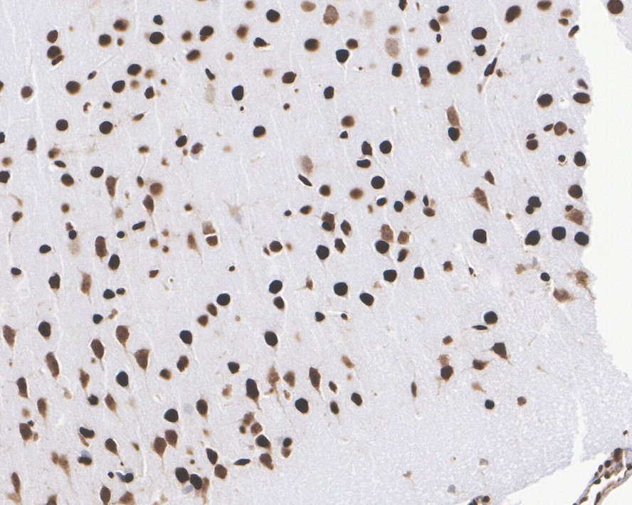 Immunohistochemical analysis of paraffin-embedded mouse hippocampus tissue with Rabbit anti-HMGB1 antibody (ET1601-2) at 1/5,000 dilution.<br />
<br />
The section was pre-treated using heat mediated antigen retrieval with sodium citrate buffer (pH 6.0) for 2 minutes. The tissues were blocked in 1% BSA for 20 minutes at room temperature, washed with ddH2O and PBS, and then probed with the primary antibody (ET1601-2) at 1/5,000 dilution for 1 hour at room temperature. The detection was performed using an HRP conjugated compact polymer system. DAB was used as the chromogen. Tissues were counterstained with hematoxylin and mounted with DPX.