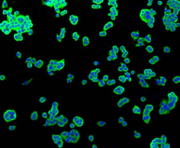 ICC staining of Alkaline Phosphatase in HepG2 cells (green). Formalin fixed cells were permeabilized with 0.1% Triton X-100 in TBS for 10 minutes at room temperature and blocked with 10% negative goat serum for 15 minutes at room temperature. Cells were probed with the primary antibody (ET1601-21, 1/50) for 1 hour at room temperature, washed with PBS. Alexa Fluor®488 conjugate-Goat anti-Rabbit IgG was used as the secondary antibody at 1/1,000 dilution. The nuclear counter stain is DAPI (blue).