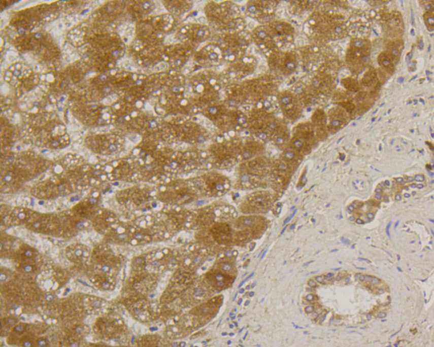 ICC staining of Alkaline Phosphatase in SW480 cells (green). Formalin fixed cells were permeabilized with 0.1% Triton X-100 in TBS for 10 minutes at room temperature and blocked with 10% negative goat serum for 15 minutes at room temperature. Cells were probed with the primary antibody (ET1601-21, 1/50) for 1 hour at room temperature, washed with PBS. Alexa Fluor®488 conjugate-Goat anti-Rabbit IgG was used as the secondary antibody at 1/1,000 dilution. The nuclear counter stain is DAPI (blue).