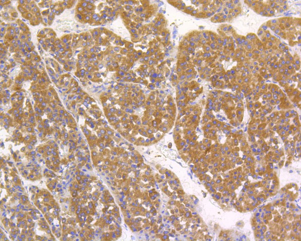 Immunohistochemical analysis of paraffin-embedded human liver tissue using anti-Alkaline Phosphatase antibody. The section was pre-treated using heat mediated antigen retrieval with Tris-EDTA buffer (pH 9.0) for 20 minutes.The tissues were blocked in 5% BSA for 30 minutes at room temperature, washed with ddH2O and PBS, and then probed with the primary antibody (ET1601-21, 1/50) for 30 minutes at room temperature. The detection was performed using an HRP conjugated compact polymer system. DAB was used as the chromogen. Tissues were counterstained with hematoxylin and mounted with DPX.