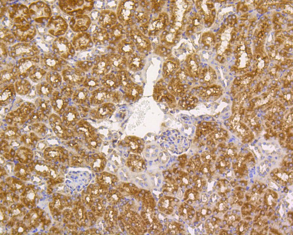 Immunohistochemical analysis of paraffin-embedded human kidney tissue using anti-Alkaline Phosphatase antibody. The section was pre-treated using heat mediated antigen retrieval with Tris-EDTA buffer (pH 9.0) for 20 minutes.The tissues were blocked in 5% BSA for 30 minutes at room temperature, washed with ddH2O and PBS, and then probed with the primary antibody (ET1601-21, 1/50) for 30 minutes at room temperature. The detection was performed using an HRP conjugated compact polymer system. DAB was used as the chromogen. Tissues were counterstained with hematoxylin and mounted with DPX.