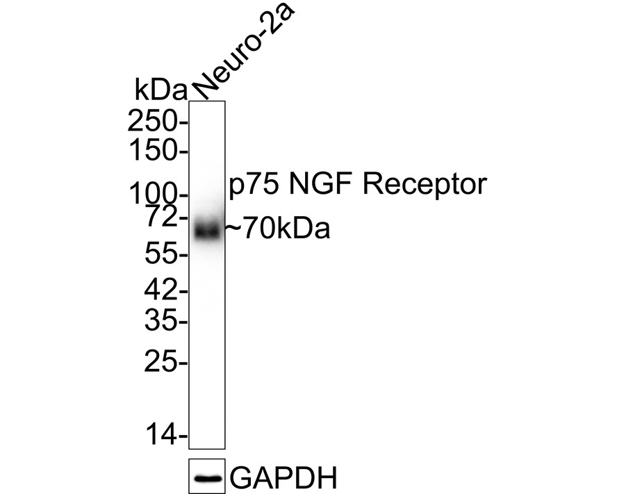 Western blot analysis of p75 NGF Receptor on skeletal muscle tissue lysates. Proteins were transferred to a PVDF membrane and blocked with 5% BSA in PBS for 1 hour at room temperature. The primary antibody (ET1601-22, 1/500) was used in 5% BSA at room temperature for 2 hours. Goat Anti-Rabbit IgG - HRP Secondary Antibody (HA1001) at 1:5,000 dilution was used for 1 hour at room temperature.