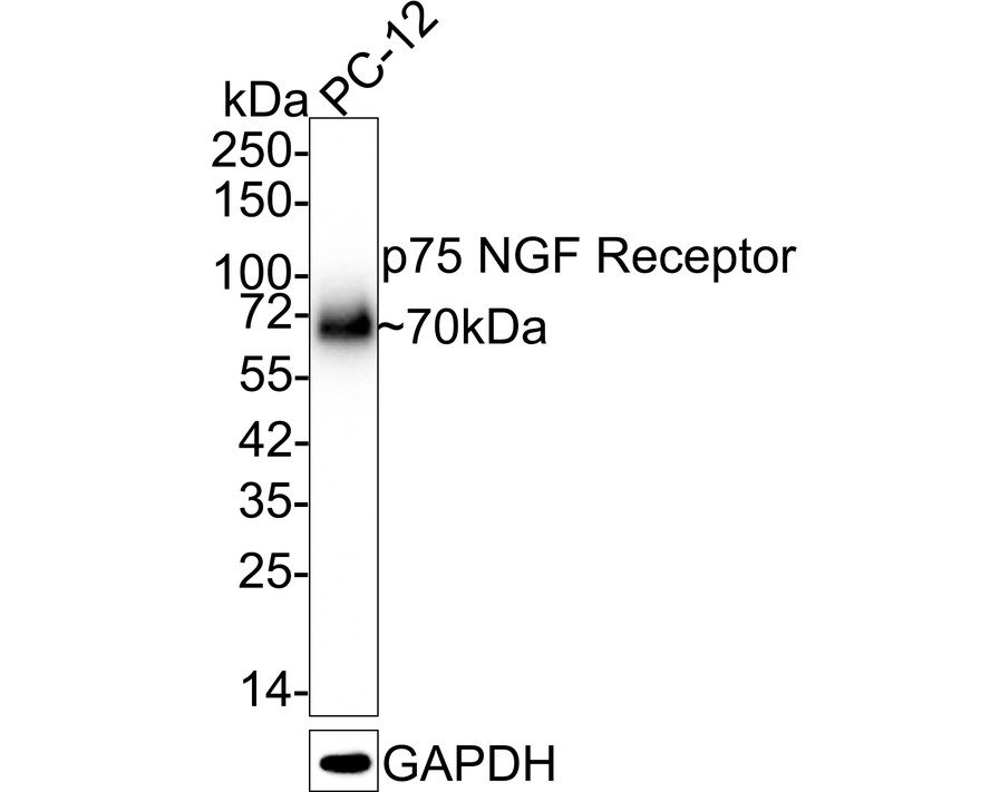 Western blot analysis of p75 NGF Receptor on PC-12 cell lysates with Rabbit anti-p75 NGF Receptor antibody (ET1601-22) at 1/1,000 dilution.<br />
<br />
Lysates/proteins at 10 µg/Lane.<br />
<br />
Predicted band size: 45 kDa<br />
Observed band size: 70 kDa<br />
<br />
Exposure time: 1 minute;<br />
<br />
8% SDS-PAGE gel.<br />
<br />
Proteins were transferred to a PVDF membrane and blocked with 5% NFDM/TBST for 1 hour at room temperature. The primary antibody (ET1601-22) at 1/1,000 dilution was used in 5% NFDM/TBST at room temperature for 2 hours. Goat Anti-Rabbit IgG - HRP Secondary Antibody (HA1001) at 1:300,000 dilution was used for 1 hour at room temperature.