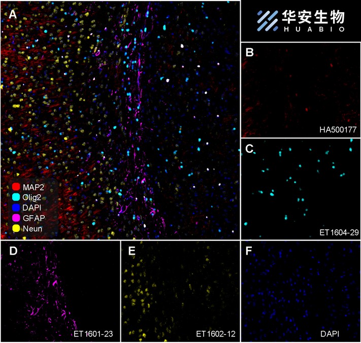 Immunofluorescence analysis of paraffin-embedded rat brain tissue labelling GFAP (ET1601-23)<br />
<br />
Upper Side - Negative Control (10% Goat Serum)<br />
Lower Side - Recombinant Rabbit monoclonal to GFAP (ET1601-23)<br />
<br />
The rat brain tissue section was pre-treated using heat mediated antigen retrieval with Tris-EDTA buffer (pH 9.0) for 20 minutes, blocked in 10% goat serum, and then incubated with ET1601-23 at 1/100 dilution , followed by iFluor™ 488 Conjugated Goat anti-rabbit IgG at 1:1,000 dilution.<br />
Confocal images shows specific cytoplasmic staining of GFAP in rat brain tissue.