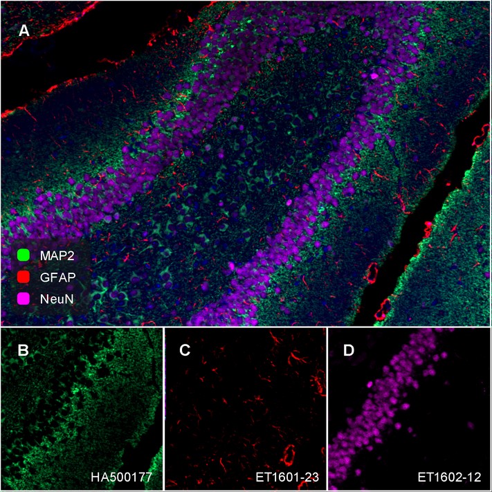 Immunofluorescence analysis of paraffin-embedded mouse brain tissue labelling GFAP (ET1601-23)<br />
<br />
Upper Side - Negative Control (10% Goat Serum)<br />
Lower Side - Recombinant Rabbit monoclonal to GFAP (ET1601-23)<br />
<br />
The mouse brain tissue section was pre-treated using heat mediated antigen retrieval with Tris-EDTA buffer (pH 9.0) for 20 minutes, blocked in 10% goat serum, and then incubated with ET1601-23 at 1/100 dilution , followed by iFluorTM 488 Conjugated Goat anti-rabbit IgG at 1:1,000 dilution.<br />
Confocal images shows specific cytoplasmic staining of GFAP in mouse brain tissue.