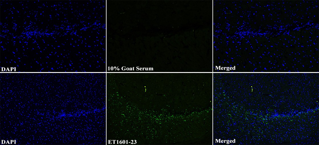Immunohistochemical analysis of paraffin-embedded mouse spinal cord tissue with Rabbit anti-GFAP antibody (ET1601-23) at 1/50 dilution.<br />
<br />
The section was pre-treated using heat mediated antigen retrieval with Tris-EDTA buffer (pH 9.0) for 20 minutes. The tissues were blocked in 1% BSA for 20 minutes at room temperature, washed with ddH2O and PBS, and then probed with the primary antibody (ET1601-23) at 1/50 dilution for 1 hour at room temperature. The detection was performed using an HRP conjugated compact polymer system. DAB was used as the chromogen. Tissues were counterstained with hematoxylin and mounted with DPX.