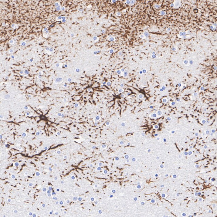 Immunohistochemical analysis of paraffin-embedded mouse brain tissue with Rabbit anti-GFAP antibody (ET1601-23) at 1/200 dilution.<br />
<br />
The section was pre-treated using heat mediated antigen retrieval with Tris-EDTA buffer (pH 9.0) for 20 minutes. The tissues were blocked in 1% BSA for 20 minutes at room temperature, washed with ddH2O and PBS, and then probed with the primary antibody (ET1601-23) at 1/200 dilution for 1 hour at room temperature. The detection was performed using an HRP conjugated compact polymer system. DAB was used as the chromogen. Tissues were counterstained with hematoxylin and mounted with DPX.