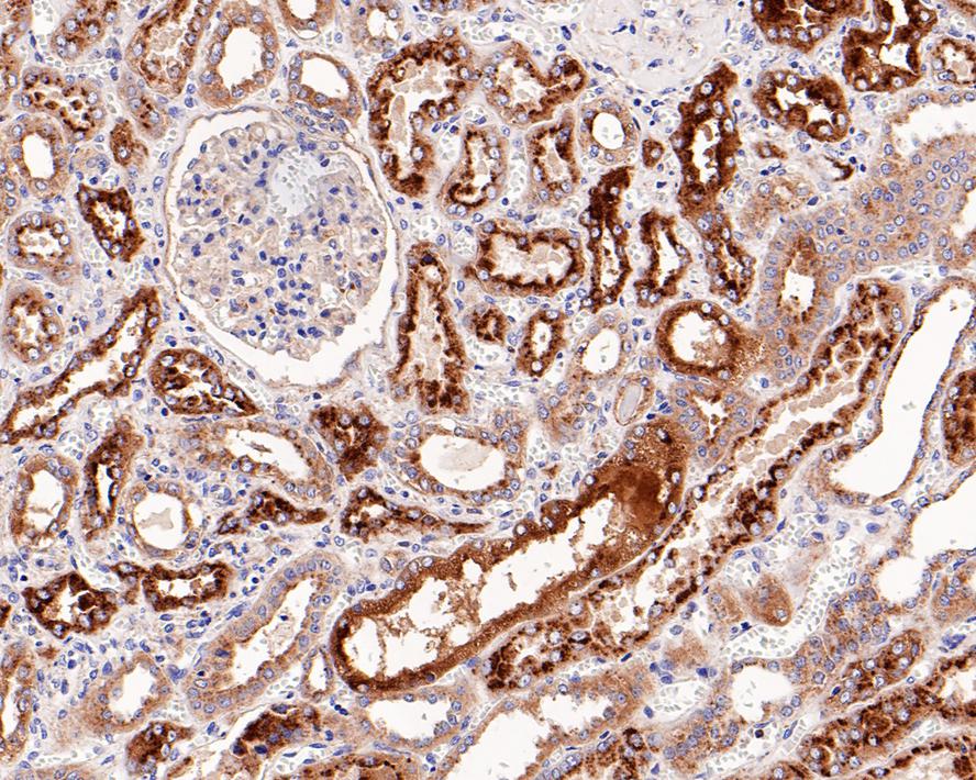 Immunohistochemical analysis of paraffin-embedded human liver tissue using anti-LAMP2a antibody. The section was pre-treated using heat mediated antigen retrieval with Tris-EDTA buffer (pH 8.0-8.4) for 20 minutes.The tissues were blocked in 5% BSA for 30 minutes at room temperature, washed with ddH2O and PBS, and then probed with the primary antibody (ET1601-24, 1/50) for 30 minutes at room temperature. The detection was performed using an HRP conjugated compact polymer system. DAB was used as the chromogen. Tissues were counterstained with hematoxylin and mounted with DPX.