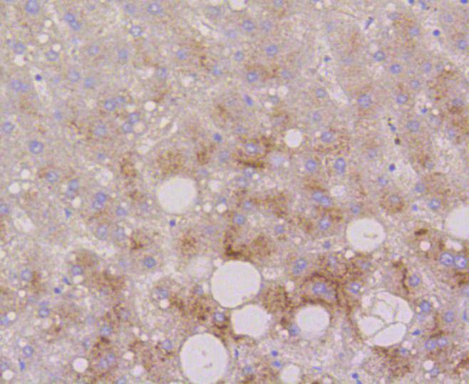 Immunohistochemical analysis of paraffin-embedded human kidney tissue using anti-LAMP2a antibody. The section was pre-treated using heat mediated antigen retrieval with Tris-EDTA buffer (pH 8.0-8.4) for 20 minutes.The tissues were blocked in 5% BSA for 30 minutes at room temperature, washed with ddH2O and PBS, and then probed with the primary antibody (ET1601-24, 1/50) for 30 minutes at room temperature. The detection was performed using an HRP conjugated compact polymer system. DAB was used as the chromogen. Tissues were counterstained with hematoxylin and mounted with DPX.