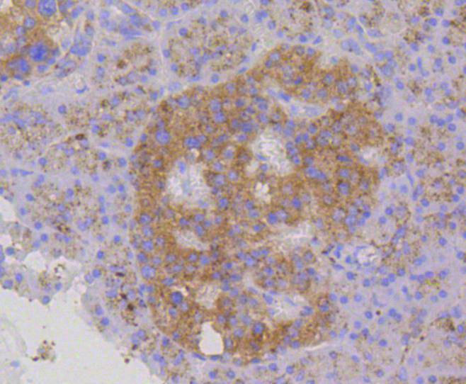 Immunohistochemical analysis of paraffin-embedded human pancreas tissue using anti-LAMP2a antibody. The section was pre-treated using heat mediated antigen retrieval with Tris-EDTA buffer (pH 8.0-8.4) for 20 minutes.The tissues were blocked in 5% BSA for 30 minutes at room temperature, washed with ddH2O and PBS, and then probed with the primary antibody (ET1601-24, 1/200) for 30 minutes at room temperature. The detection was performed using an HRP conjugated compact polymer system. DAB was used as the chromogen. Tissues were counterstained with hematoxylin and mounted with DPX.