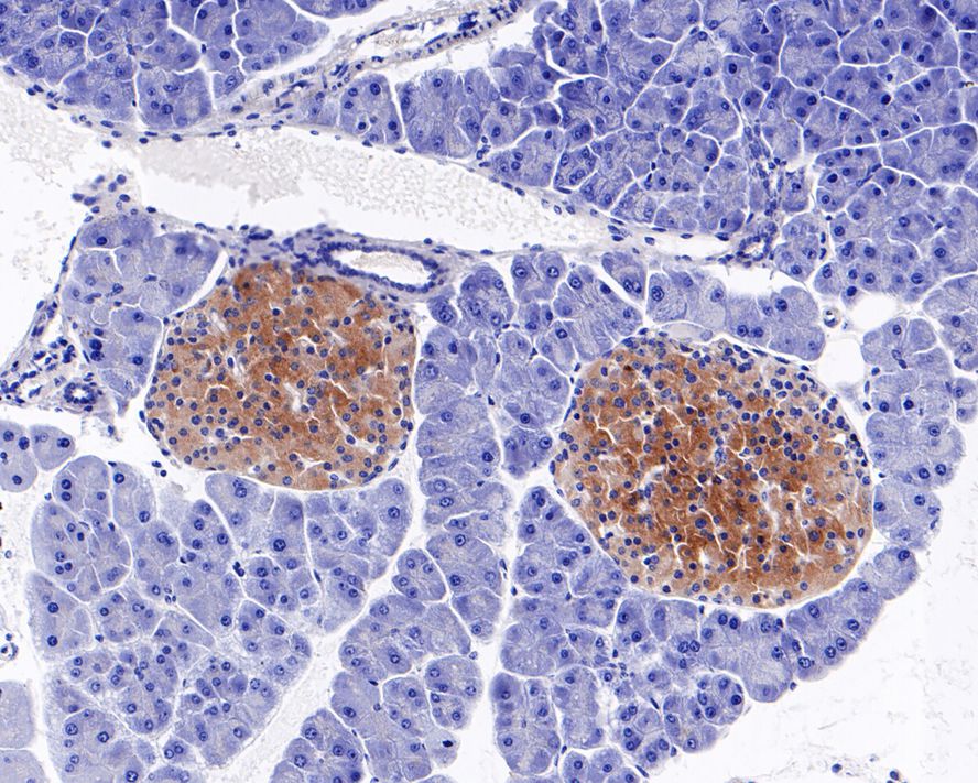 Immunohistochemical analysis of paraffin-embedded mouse pancreas tissue with Rabbit anti-LAMP2a antibody (ET1601-24) at 1/500 dilution.<br />
<br />
The section was pre-treated using heat mediated antigen retrieval with Tris-EDTA buffer (pH 9.0) for 20 minutes. The tissues were blocked in 1% BSA for 20 minutes at room temperature, washed with ddH2O and PBS, and then probed with the primary antibody (ET1601-24) at 1/500 dilution for 1 hour at room temperature. The detection was performed using an HRP conjugated compact polymer system. DAB was used as the chromogen. Tissues were counterstained with hematoxylin and mounted with DPX.