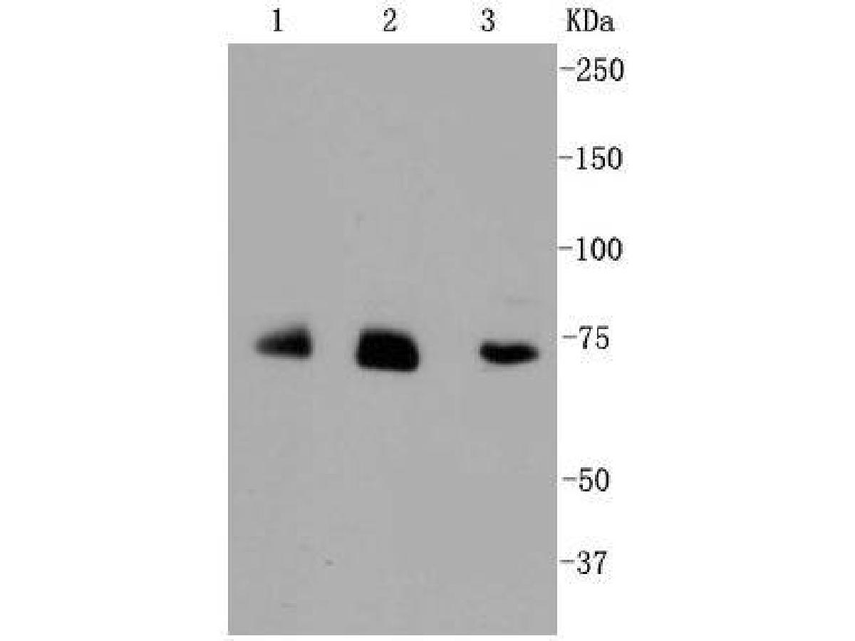 Immunocytochemistry analysis of Hela cells labeling Alas1 with Rabbit anti-Alas1 antibody (ET1601-26) at 1/50 dilution.<br />
<br />
Cells were fixed in 4% paraformaldehyde for 10 minutes at 37 ℃, permeabilized with 0.05% Triton X-100 in PBS for 20 minutes, and then blocked with 2% negative goat serum for 30 minutes at room temperature. Cells were then incubated with Rabbit anti-Alas1 antibody (ET1601-26) at 1/50 dilution in 2% negative goat serum overnight at 4 ℃. Goat Anti-Rabbit IgG H&L (iFluor™ 488, HA1121) was used as the secondary antibody at 1/1,000 dilution. PBS instead of the primary antibody was used as the secondary antibody only control. Nuclear DNA was labelled in blue with DAPI.