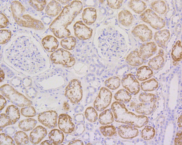 Immunohistochemical analysis of paraffin-embedded human kidney tissue using anti-RPS3 antibody. The section was pre-treated using heat mediated antigen retrieval with Tris-EDTA buffer (pH 8.0-8.4) for 20 minutes.The tissues were blocked in 5% BSA for 30 minutes at room temperature, washed with ddH2O and PBS, and then probed with the primary antibody (ET1601-27, 1/50) for 30 minutes at room temperature. The detection was performed using an HRP conjugated compact polymer system. DAB was used as the chromogen. Tissues were counterstained with hematoxylin and mounted with DPX.