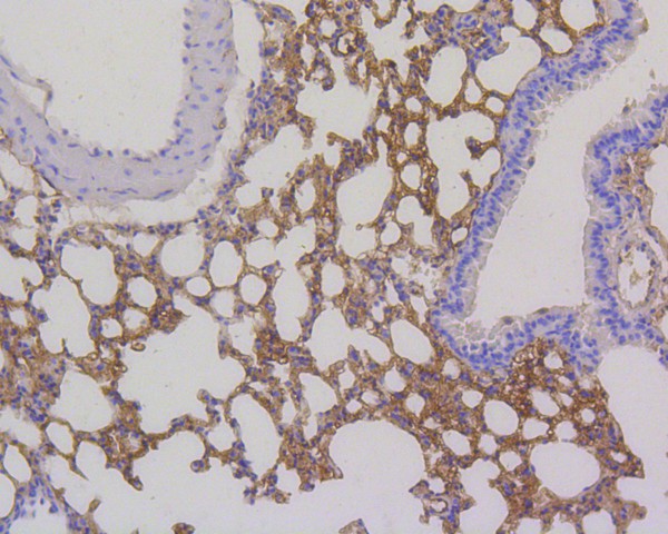 Immunohistochemical analysis of paraffin-embedded mouse lung tissue using anti-RPS3 antibody. The section was pre-treated using heat mediated antigen retrieval with Tris-EDTA buffer (pH 8.0-8.4) for 20 minutes.The tissues were blocked in 5% BSA for 30 minutes at room temperature, washed with ddH2O and PBS, and then probed with the primary antibody (ET1601-27, 1/200) for 30 minutes at room temperature. The detection was performed using an HRP conjugated compact polymer system. DAB was used as the chromogen. Tissues were counterstained with hematoxylin and mounted with DPX.
