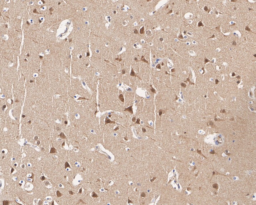 Immunohistochemical analysis of paraffin-embedded human brain tissue with Rabbit anti-JNK1+JNK2+JNK3 antibody (ET1601-28) at 1/1,000 dilution.<br />
<br />
The section was pre-treated using heat mediated antigen retrieval with sodium citrate buffer (pH 6.0) for 2 minutes. The tissues were blocked in 1% BSA for 20 minutes at room temperature, washed with ddH2O and PBS, and then probed with the primary antibody (ET1601-28) at 1/1,000 dilution for 1 hour at room temperature. The detection was performed using an HRP conjugated compact polymer system. DAB was used as the chromogen. Tissues were counterstained with hematoxylin and mounted with DPX.