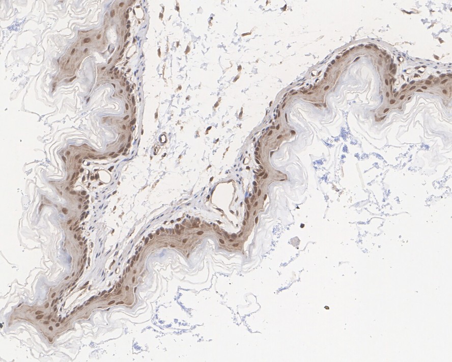 ICC staining of ERK1/2 in A549 cells (green). Formalin fixed cells were permeabilized with 0.1% Triton X-100 in TBS for 10 minutes at room temperature and blocked with 1% Blocker BSA for 15 minutes at room temperature. Cells were probed with the primary antibody (ET1601-29, 1/50) for 1 hour at room temperature, washed with PBS. Alexa Fluor®488 Goat anti-Rabbit IgG was used as the secondary antibody at 1/1,000 dilution. The nuclear counter stain is DAPI (blue).