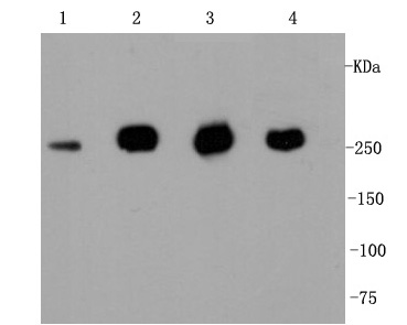 Western blot analysis of Filamin A on different lysates. Proteins were transferred to a PVDF membrane and blocked with 5% BSA in PBS for 1 hour at room temperature. The primary antibody (ET1601-3, 1/500) was used in 5% BSA at room temperature for 2 hours. Goat Anti-Rabbit IgG - HRP Secondary Antibody (HA1001) at 1:5,000 dilution was used for 1 hour at room temperature.<br />
Positive control: <br />
Lane 1: MCF-7 cell lysate<br />
Lane 2: Jurkat cell lysate<br />
Lane 3: Hela cell lysate<br />
Lane 4: NIH/3T3 cell lysate