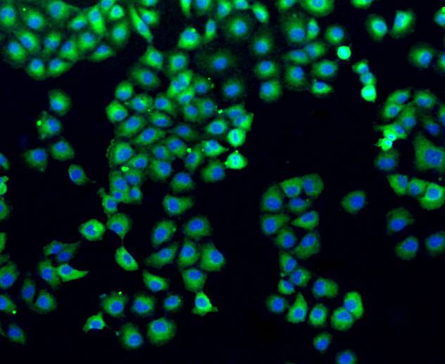 ICC staining of Filamin A in HUVEC cells (green). Formalin fixed cells were permeabilized with 0.1% Triton X-100 in TBS for 10 minutes at room temperature and blocked with 1% Blocker BSA for 15 minutes at room temperature. Cells were probed with the primary antibody (ET1601-3, 1/50) for 1 hour at room temperature, washed with PBS. Alexa Fluor®488 Goat anti-Rabbit IgG was used as the secondary antibody at 1/1,000 dilution. The nuclear counter stain is DAPI (blue).